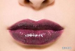 嘴唇发紫是什么原因 嘴唇发紫怎么治疗