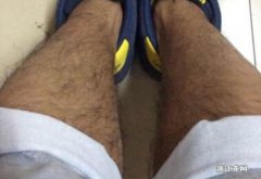 男人腿毛长代表什么 男人腿毛少没有福气吗